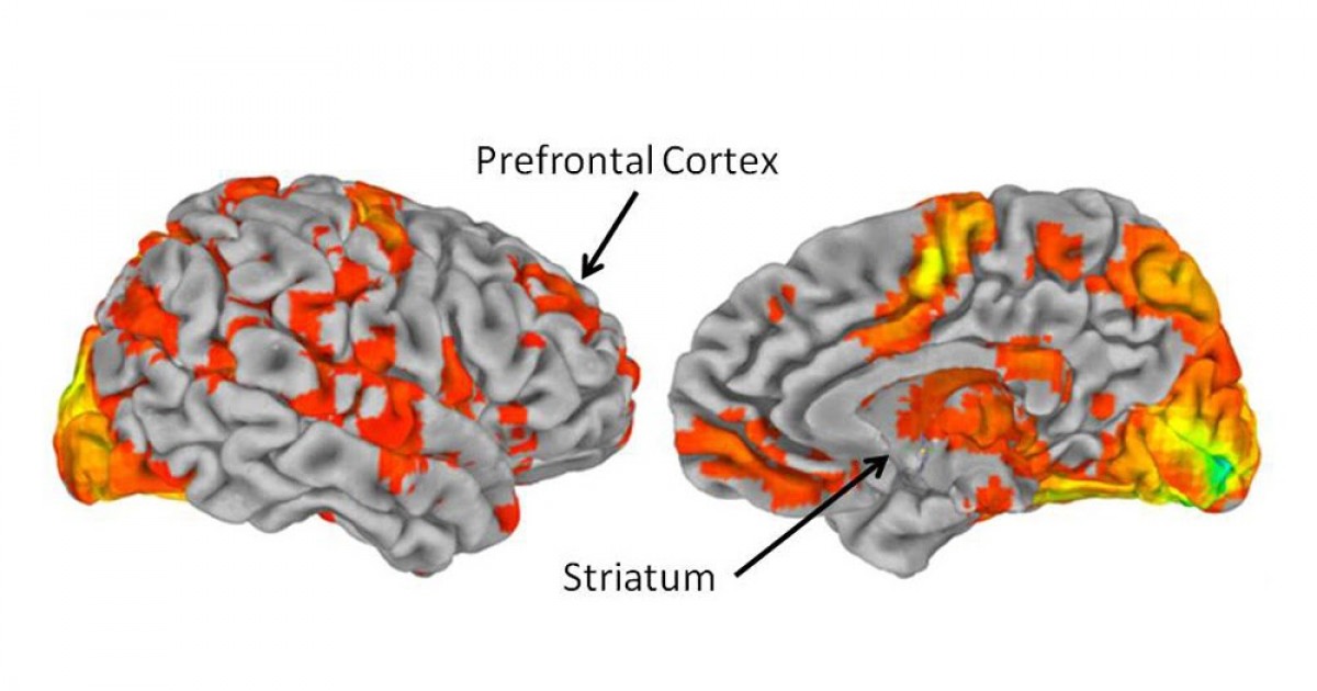 L'amore per la musica studiato con uno scan del cervello